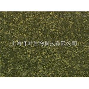 RIN-M5F(大鼠胰島Β細(xì)胞瘤細(xì)胞)