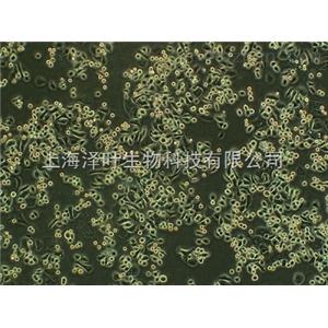 A7R5(大鼠胸大動(dòng)脈平滑肌細(xì)胞)
