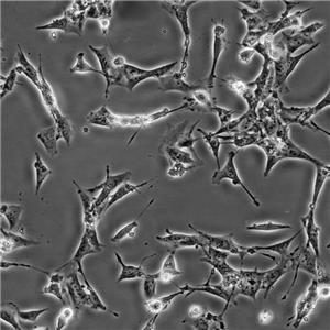 MCF7[MCF-7] Cells人乳腺癌復蘇細胞系(有STR鑒定圖譜)