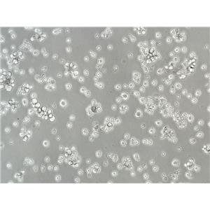 CHLA-221 Cells人細胞|僅提供STR圖譜